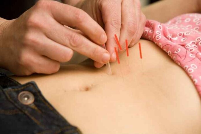 6 Interesting Facts About Acupuncture